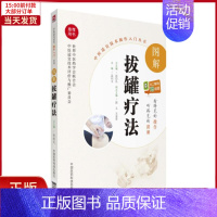 [正版]全新 图解拔罐疗法 医学卫生/中医 9787506795685