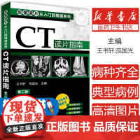 正版 影像读片从入门到精通系列 CT读片指南 第二版 医学药学医学影像CT诊断影像临床诊断 基层影像医师影像科新手实用参