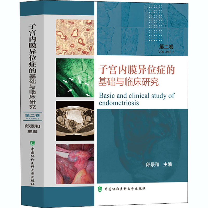 子宫内膜异位症的基础与临床研究(第2卷)