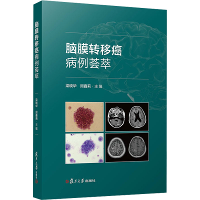 [M]脑膜转移癌病例荟萃-9787309169928