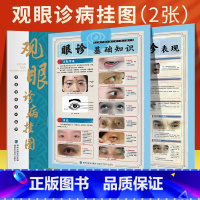 [正版]47厘米*68厘米2张眼诊全彩挂图 观眼诊病挂图 中医望诊系列挂图中医常见病症简单医治中医养生中医入门 书籍中