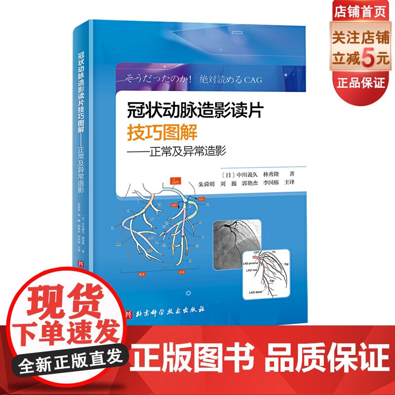 冠状动脉造影读片技巧图解 正常及异常造影 教你从冠脉造影小白 快速进阶PCI达人 日本视频版 扫码免费看视频 北京科学技