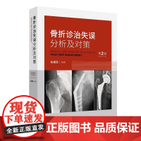 骨折诊治失误分析及对策(第2版)