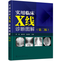 音像实用临床X线诊断图解(第2版)编者:李泉//翟长彬//张成周