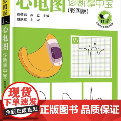 心电图诊断掌中宝彩图版 苏立 心电图图形各种波段识别测量临床医师看心电图方法技巧 临床心电图诊断心电图识图图书