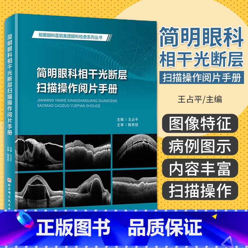 [正版]简明眼科相干光断层扫描操作阅片手册 王占平 北京科学技术出版社 朝聚眼科医院集团眼科检查系列丛书 眼科手册眼科