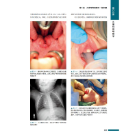 [M]Cummings耳鼻咽喉头颈外科学 第6分册 儿童耳鼻咽喉学 原书第6版-9787504688026