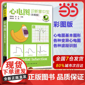心电图诊断掌中宝彩图版 苏立 心电图图形各种波段识别测量临床医师看心电图方法技巧 临床心电图诊断心电图识图图书