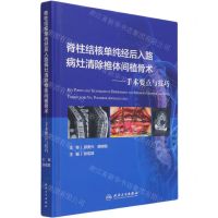 [N]脊柱结核单纯经后入路病灶清除椎体间植骨术--手术要点与技巧(精)-9787117313681