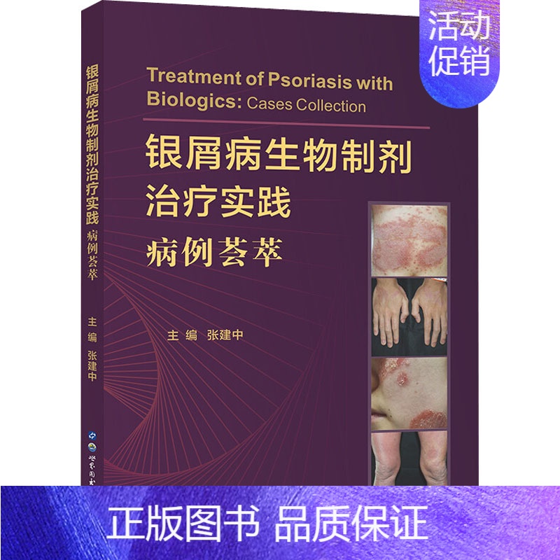 [正版]银屑病生物制剂治疗实践 病例荟萃 张建中 编 皮肤病学/性病学生活 书店图书籍 世界图书出版公司