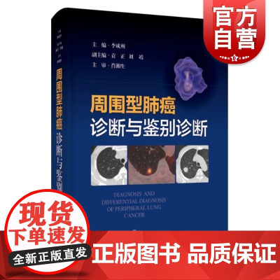 周围型肺癌诊断与鉴别诊断 李成州上海科学技术出版社