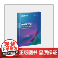 肺癌PET/CT