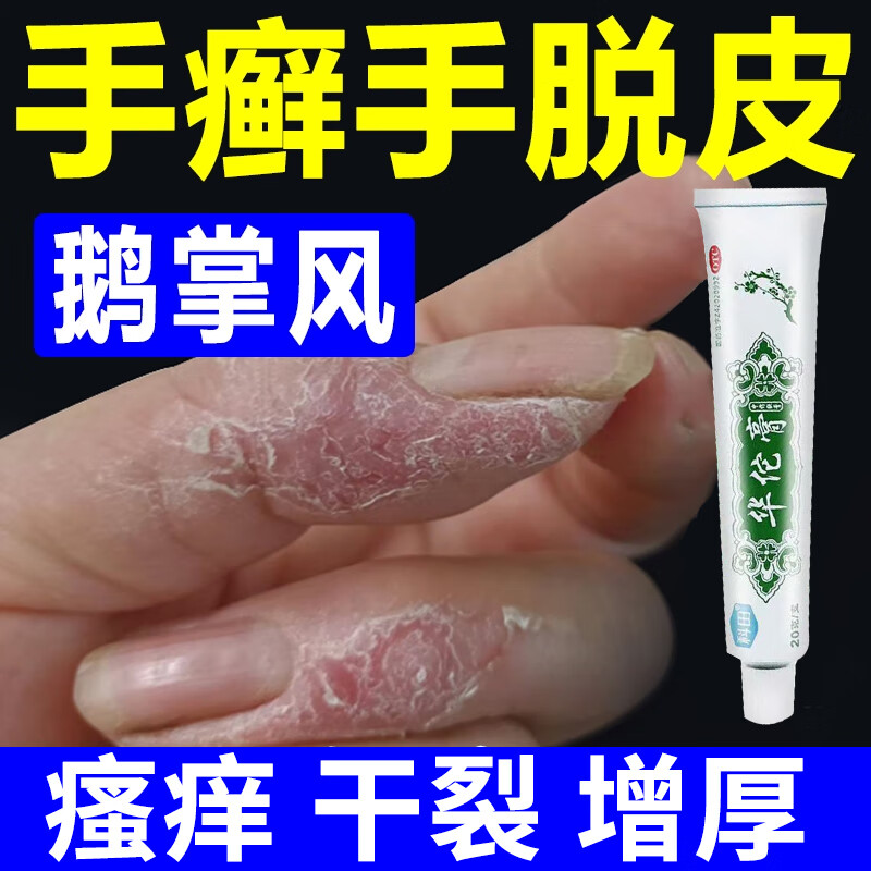 治鹅掌风药膏干裂脱皮手癣膏手掌粗糙变厚脱皮开裂真菌感染用药脱屑