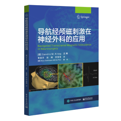 导航经颅磁刺激在神经外科的应用