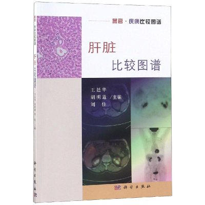 [M]肝脏比较图谱-9787030594556