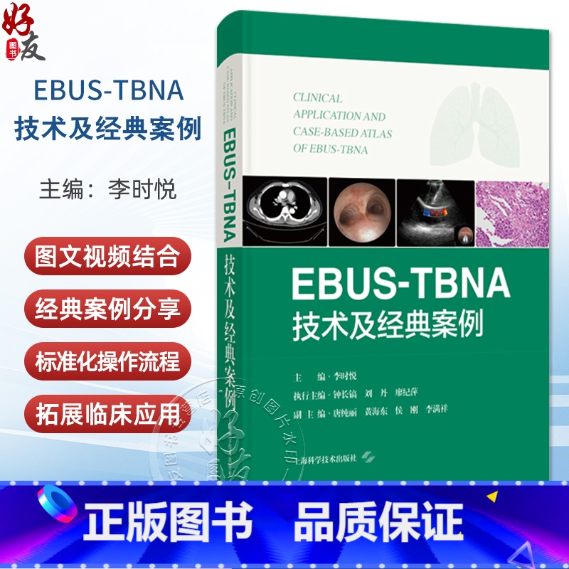 EBUS-TBNA技术及经典案例 超声内镜引导下经支气管针吸活检术 李时悦主编 上海科学技术出版社9787547867