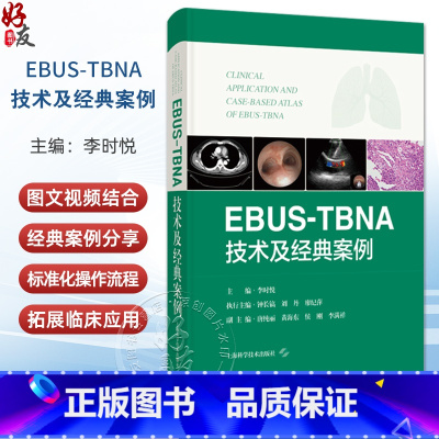 EBUS-TBNA技术及经典案例 超声内镜引导下经支气管针吸活检术 李时悦主编 上海科学技术出版社9787547867