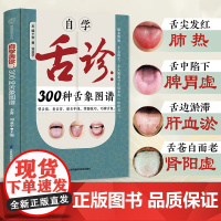 自学舌诊 300种舌象图谱 李勇 等 编著 医学