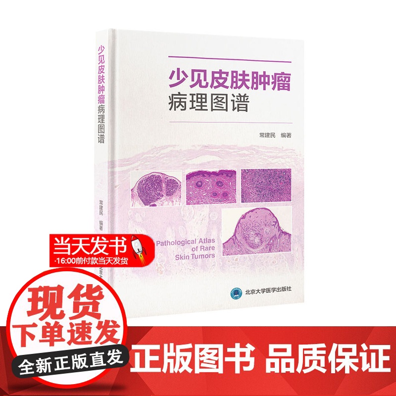 正版 少见皮肤肿瘤病理图谱 常建民 北京大学医学出版社 适合皮肤科医师以及病理科医师参考使用 佩吉特样鲍恩病 黑素棘皮瘤