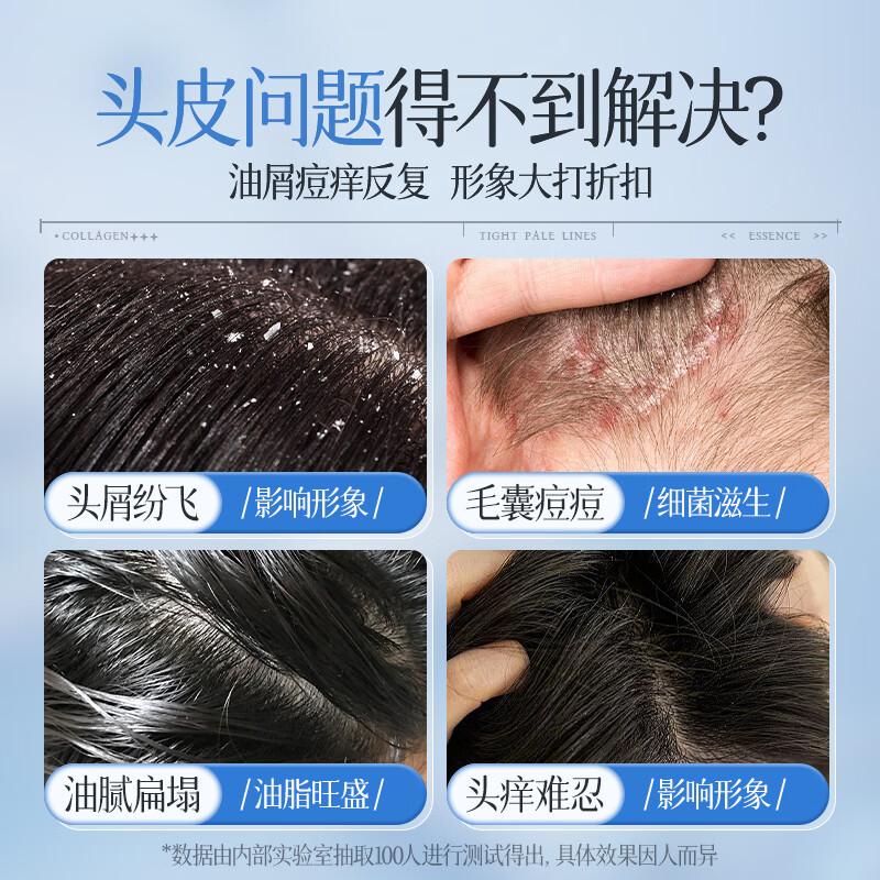 儒意二硫化硒净屑清爽洗发水500ml