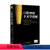 [正版]口腔种植手术学图解 王少海 马威 主编 配增值 口腔科学 9787117212731 人民卫生出版社 临床医生