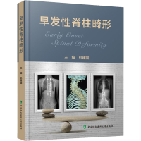 正版新书]早发性脊柱畸形仉建国9787567919587