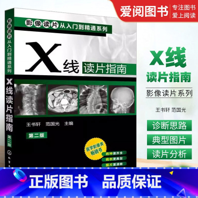 [正版]X线读片指南 第二版 王书轩 化学工业出版社 全面覆盖基层常见病及多发病中枢神经系统与头颈部读片基础书籍