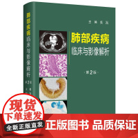 书2025新版]肺部疾病临床与影像解析第2二版张嵩肺部疾病的临床影像特点影像的诊断和鉴别诊断大量病例9787030808