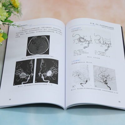 [正版]脑动脉瘤旁路手术 孙正辉 编 外科学参考资料图书 医学类专业书籍