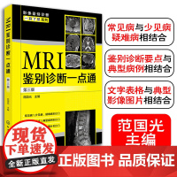 MRI鉴别诊断一点通 第三版 范国光 医学影像学 影像科医师参考图书籍 影像医生和相关专业的参考书 临床科室医生参考学习