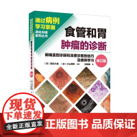 正版 食管和胃肿瘤的诊断 明确鉴别诊断和深度诊断的技巧及病例学习 修订版 消化内镜系列丛书 辽宁科学技术出版社