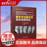[央视网]髋关节与膝关节假体周围骨折 一部实用的骨科学工具书ZK