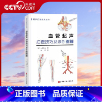 [正版]央视网血管超声扫查技巧及诊断图解 日本持续 超声扫查技术丛书 血管解剖—扫查方法—诊断要点 一看就明白准确
