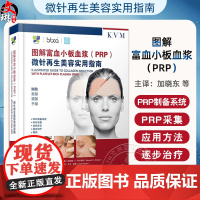 图解富血小板血浆(PRP)微针再生美容实用指南(德)伯纳德·C.科尔斯特 主编 附加内容二维码 978755914057