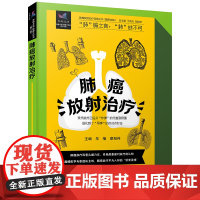 肺癌放射治疗 肺癌