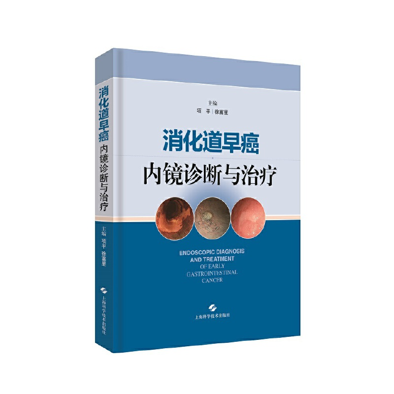 音像消化道早癌内镜诊断与治疗主编 项平 徐富星
