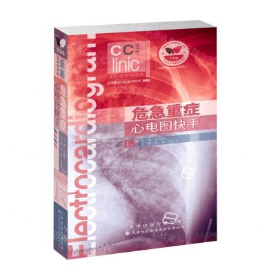 [N]危急重症心电图快手(全彩医学插画本)/心电图入门口袋书系列-9787543342699