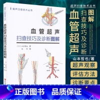 [正版]血管超声扫查技巧及诊断图解 山本哲也 著 超声扫查技术丛书 椎动脉系统的解剖 主动脉超声 北京科学技术出版社